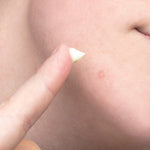 Sulfur Spot Treatment Sulfur Spot Treatment